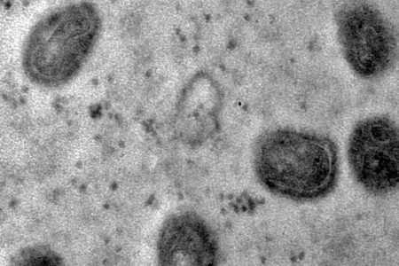 Santa Catarina registra 14 casos de Mpox em 2024