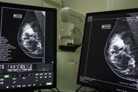 Governo de SC lança mutirão de mamografias no mês da Mulher