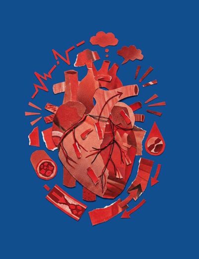 A cada 72 segundos, uma pessoa morre por doença cardiovascular no País